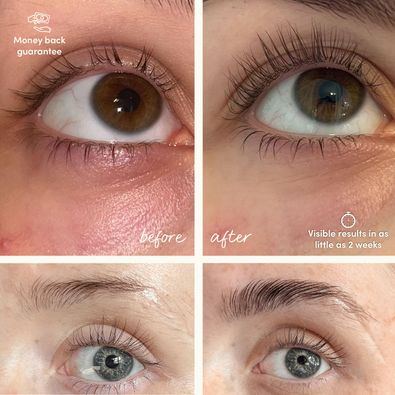 Mini Growth Starter Kit