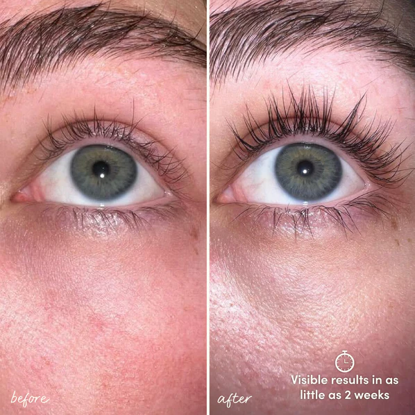 Recharge + Grow Edit